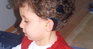 Kulağında koklear implant cihazı olan kıvırcık saçlı küçük çocuk